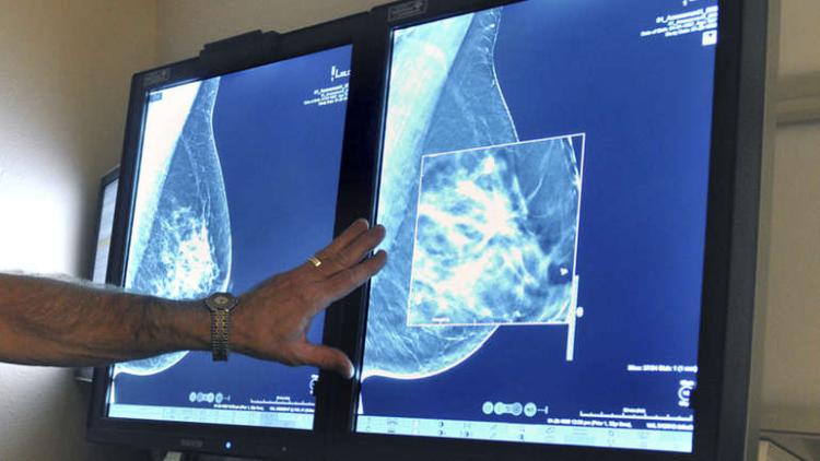 mamografija ap