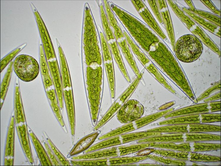 closterium euglena diatoms