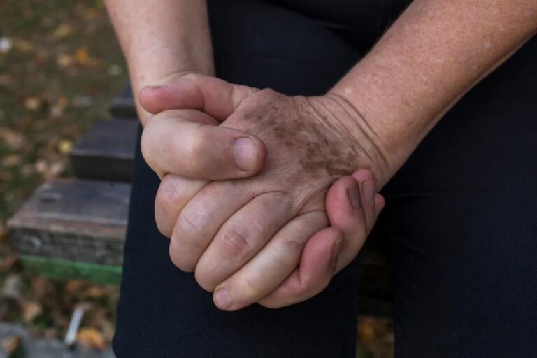 Prva godina od uključivanja žrtava ratne torture u banjsku rehabilitaciju: između oporavka i želje za napretkom