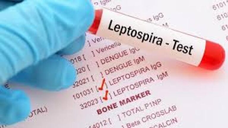 TENDERSKA DOKUMENTACIJA POKAZUJE: Sarajlije obolijevaju od leptospiroze zbog kašnjenja administracije