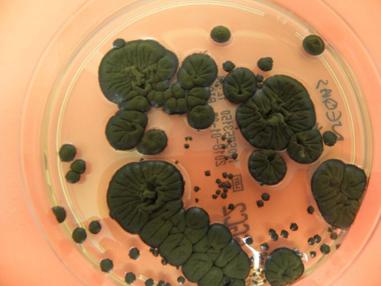 Černobilska gljivica je razvila nevjerovatnu sposobnost kroz jonizirajuće zračenje